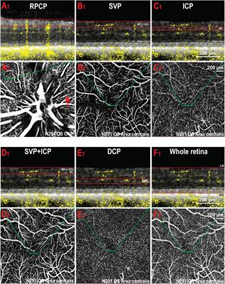 Characterization of the Canine Retinal Vasculature With Optical Coherence Tomography Angiography: Comparisons With Histology and Fluorescein Angiography